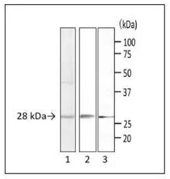 Anti-Staphylococcus aureus Enterotoxin A + Enterotoxin B antibody [sa-01] used in Western Blot (WB). GTX00864