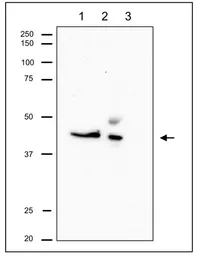 Anti-RRM2 antibody used in Immunoprecipitation (IP). GTX00888