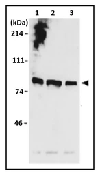 Anti-MCM7 antibody used in Western Blot (WB). GTX00894