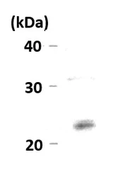 Anti-HP1 gamma antibody used in Western Blot (WB). GTX00898