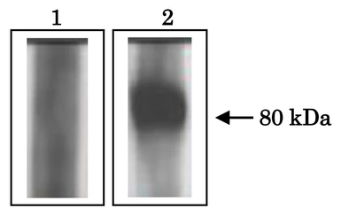 Anti-ACE3 antibody used in Immunoprecipitation (IP). GTX00904