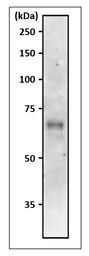 Anti-Asparagine synthetase antibody used in Western Blot (WB). GTX00925