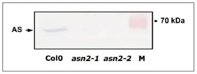 Anti-Asparagine synthetase antibody used in Western Blot (WB). GTX00925
