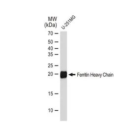 Anti-Ferritin Heavy Chain antibody [GT1149] used in Western Blot (WB). GTX00928