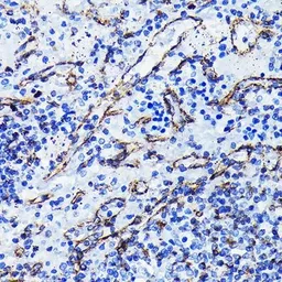 Anti-Vimentin antibody [GT1180] used in IHC (Paraffin sections) (IHC-P). GTX00942