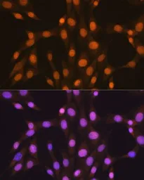 Anti-ELAVL1 / HuR antibody [GT1182] used in Immunocytochemistry/ Immunofluorescence (ICC/IF). GTX00944
