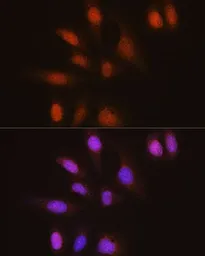 Anti-ELAVL1 / HuR antibody [GT1182] used in Immunocytochemistry/ Immunofluorescence (ICC/IF). GTX00944