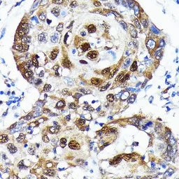 Anti-SQSTM1 / P62 antibody [GT1193] used in IHC (Paraffin sections) (IHC-P). GTX00955