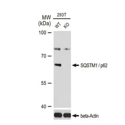 Anti-SQSTM1 / P62 antibody [GT1193] used in Western Blot (WB). GTX00955