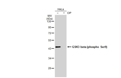 Anti-GSK3 beta (phospho Ser9) antibody [GT1209] used in Western Blot (WB). GTX00971