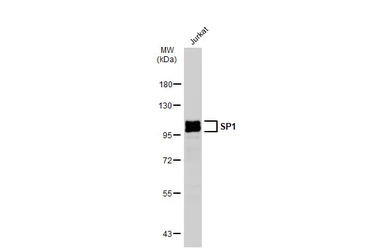 Anti-SP1 antibody [JF0950] used in Western Blot (WB). GTX01012