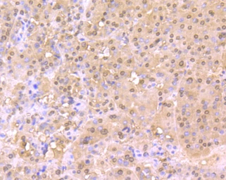 Anti-Cullin 4a antibody [JU07-33] used in IHC (Paraffin sections) (IHC-P). GTX01050