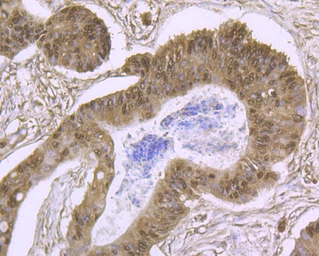 Anti-Cullin 4a antibody [JU07-33] used in IHC (Paraffin sections) (IHC-P). GTX01050