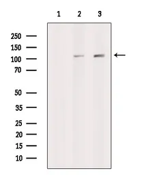 Anti-XRN2 antibody used in Western Blot (WB). GTX01072