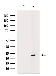 Anti-Lipocalin-2 antibody used in Western Blot (WB). GTX01078