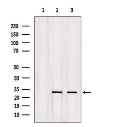 Anti-Lipocalin-2 antibody used in Western Blot (WB). GTX01078