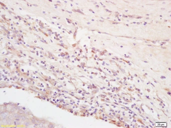 Anti-Integrin alpha V + beta 3 antibody used in IHC (Paraffin sections) (IHC-P). GTX01084