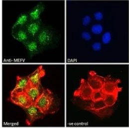 Anti-MEFV antibody used in Immunocytochemistry/ Immunofluorescence (ICC/IF). GTX01092