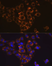 Anti-Caspase 6 antibody [GT1154] used in Immunocytochemistry/ Immunofluorescence (ICC/IF). GTX01097