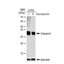 Anti-Caspase 6 antibody [GT1154] used in Western Blot (WB). GTX01097