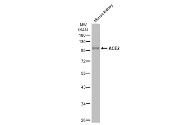 Anti-ACE2 antibody [SN0754] used in Western Blot (WB). GTX01160