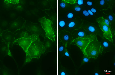 Anti-ACE2 antibody [SN0754] used in Immunocytochemistry/ Immunofluorescence (ICC/IF). GTX01160