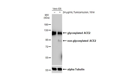 Anti-ACE2 antibody [SN0754] used in Western Blot (WB). GTX01160
