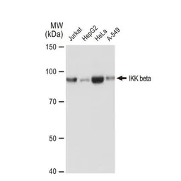 Anti-IKK beta antibody [GT1216] used in Western Blot (WB). GTX01197