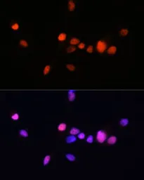 Anti-Androgen Receptor antibody [GT1228] used in Immunocytochemistry/ Immunofluorescence (ICC/IF). GTX01536