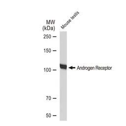 Anti-Androgen Receptor antibody [GT1228] used in Western Blot (WB). GTX01536