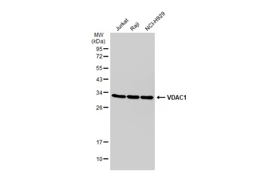 Anti-VDAC1 antibody [GT1235] used in Western Blot (WB). GTX01543