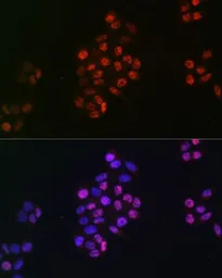 Anti-SOX9 antibody [GT1219] used in Immunocytochemistry/ Immunofluorescence (ICC/IF). GTX01545