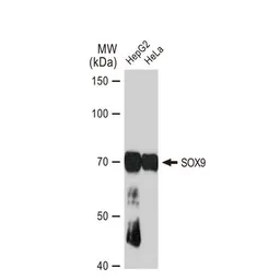 Anti-SOX9 antibody [GT1219] used in Western Blot (WB). GTX01545