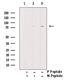 Anti-HSL (phospho Ser853) antibody used in Western Blot (WB). GTX01573
