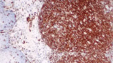 Anti-CD45 antibody [X16/99] used in IHC (Paraffin sections) (IHC-P). GTX01850