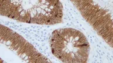 Anti-beta Catenin antibody [17C2] used in IHC (Paraffin sections) (IHC-P). GTX01865