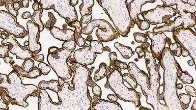 Anti-EGFR antibody [EGFR.113] used in IHC (Paraffin sections) (IHC-P). GTX01874