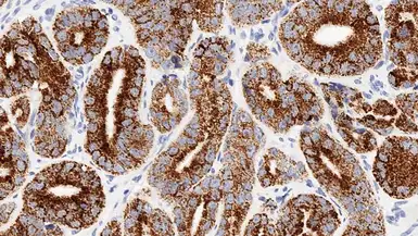 Anti-AMACR antibody [EPMU1] used in IHC (Paraffin sections) (IHC-P). GTX01883