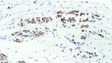 Anti-Mesothelin antibody [5B2] used in IHC (Paraffin sections) (IHC-P). GTX01948