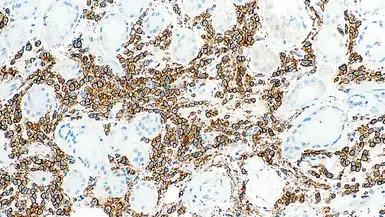 Anti-CD38 antibody [SPC32] used in IHC (Paraffin sections) (IHC-P). GTX01959