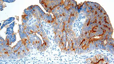 Anti-Folate Receptor alpha antibody [BN3.2] used in IHC (Paraffin sections) (IHC-P). GTX01976