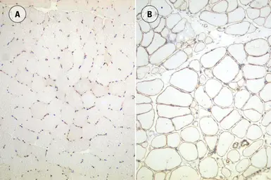 Anti-Utrophin antibody [DRP3/20C5] used in IHC (Frozen sections) (IHC-Fr). GTX01977