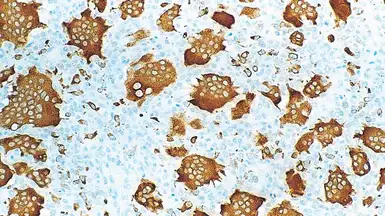 Anti-TRAP antibody [26E5] used in IHC (Paraffin sections) (IHC-P). GTX01978