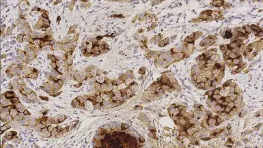 Anti-GCDFP15 antibody [23A3] used in IHC (Paraffin sections) (IHC-P). GTX01983