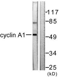 Anti-Cyclin A1 antibody used in Western Blot (WB). GTX02524