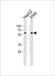 Anti-USP22 antibody used in Western Blot (WB). GTX02528