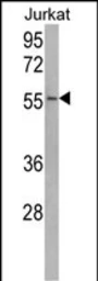 Anti-USP22 antibody used in Western Blot (WB). GTX02528
