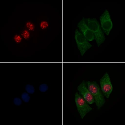 Anti-PPAR gamma (phospho Ser112) antibody used in Immunocytochemistry/ Immunofluorescence (ICC/IF). GTX02531