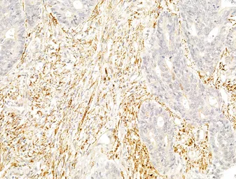 Anti-PPAR gamma (phospho Ser112) antibody used in IHC (Paraffin sections) (IHC-P). GTX02531
