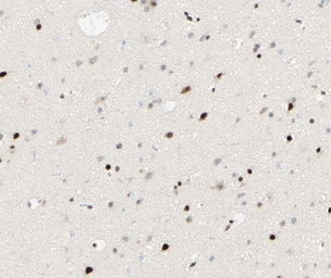 Anti-PPAR gamma (phospho Ser112) antibody used in IHC (Paraffin sections) (IHC-P). GTX02531